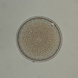Antique Microscope Slide. Actinocyclus Pruinosus Diatoms