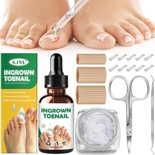 Ingrown Toenail Kit - Ingrown Toenail Drops, Ingrown Toenail Set - 60 Pcs Toe...