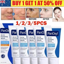 Acne Foaming Wash for Face & Body 4% 10% Benzoyl Peroxide Acne Foaming Cleanser