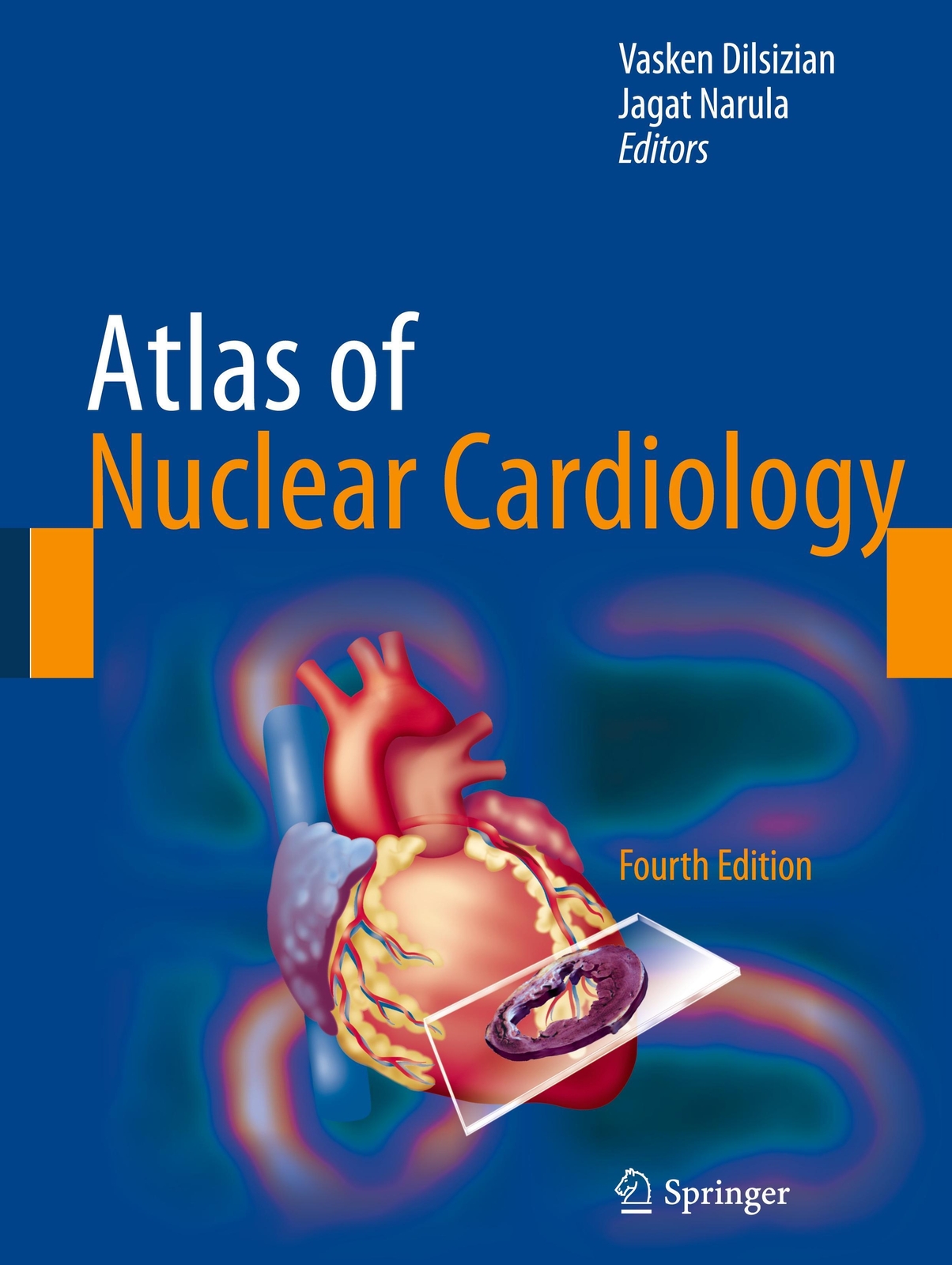 Thumbnail - Atlas Of Nuclear Cardiology | Vasken Dilsizian (u. A.) | Englisch |