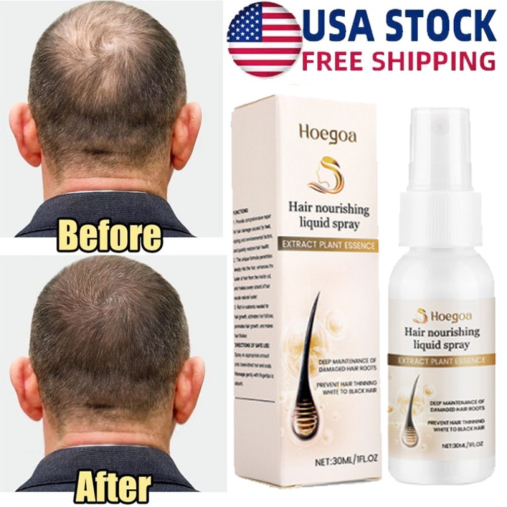 Hair Growth Spray, Grow Hair Fast, Hair Loss Treatment Serum