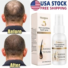 Hair Growth Spray, Grow Hair Fast, Hair Loss Treatment Serum for Men Women 30ML