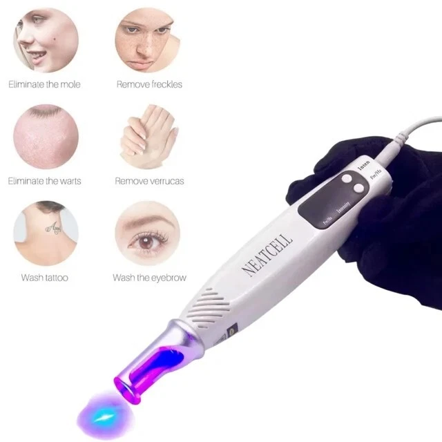 Pluma Laser Eliminador De Tatuajes, Berrudas, Lunares, Uñas Unicomicosis - Изображение 2 из 4