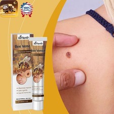 Bee Venom Ointment   Gently Cleans Body Skin Moisturizes Moles Aid   