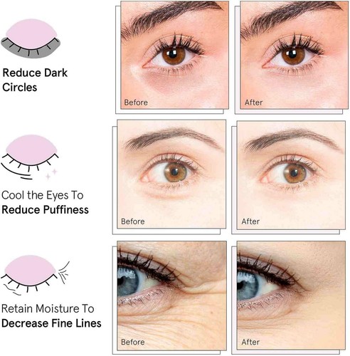 Award Winning Under Eye Mask - Reduce Dark Circles, Puffy Eyes, Undereye Bags, - Picture 3 of 5