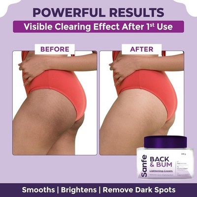 Sanfe Back & Bum Cream for Dark Spots and Body Acne | Glycolic Acid, Lactic 100g