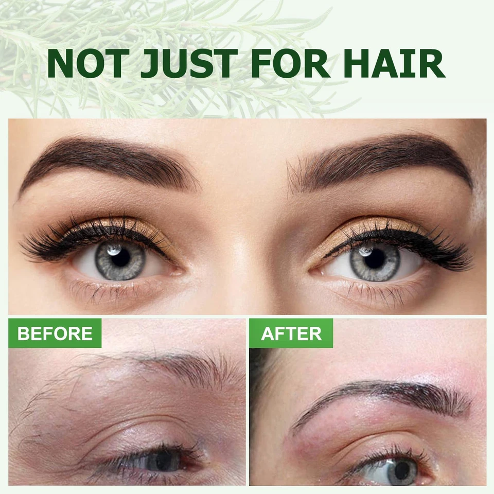 Rosemary Oil for Hair Growth, Eyebrow Eyelash Growth Skin Care 100% Pure Natural - Image 4 of 4