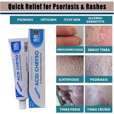 Crema Para Dermatitis Eczema Psoriasis Para Comezon Picazon Ronchas En La Piel