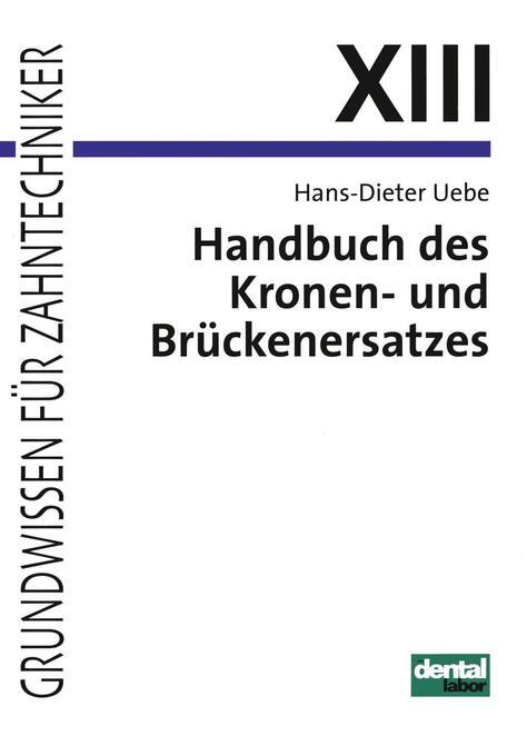 Thumbnail - Handbuch Des Kronen- Und Brückenersatzes | Hans-dieter Uebe | 2013 |