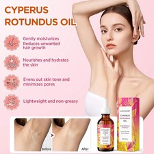 Cyperus Rotundus Oil 60ml Natural Hair Removal Inhibitor Body Care Skin Oil New