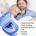NHS Reducing Snore Stopper Stop Anti Snoring Mouth Guard Apnoea Device Sleep Aid