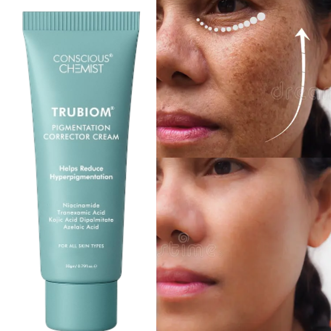 Kojic Acid Face Cream for Anti Pigmentation & Reduce Dark Spots - 20 Gm