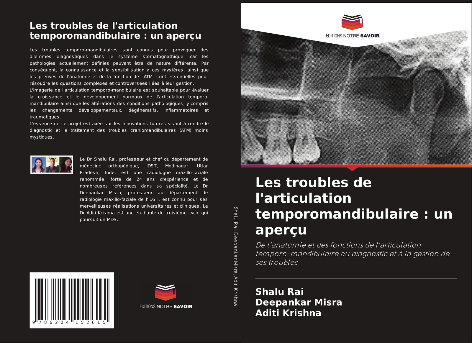 Thumbnail - Shalu Rai (u. A.) | Les Troubles De L'articulation Temporomandibulaire
