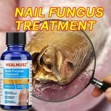 HEALMUSZ Multi-Purpose Treatment for Toenail & Fingernails Repair Solution 30ml