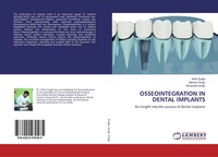 Ankit Singla (U. A.) | Osseointegration In Dental Implants | Taschenbuch (2019)