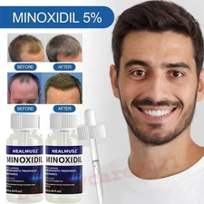 Minoxidil 5% Topical Solution for Men Hair Regrowth, Reactivates Hair Follicles
