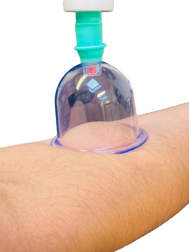 12PCS Cupping Vacuum Massage Cups Therapy Set Health Acupuncture Suction UK - Picture 3 of 11