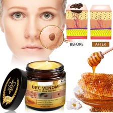 Upgrade Bee Venom All-in-One Cream, Professional Bee Venom Skin Treatment Cream
