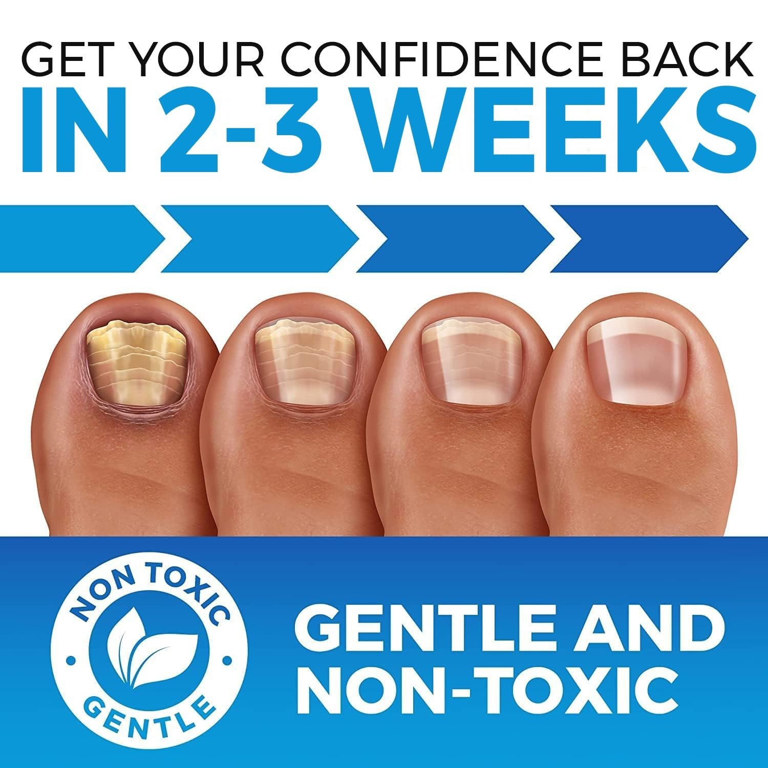 как выглядит Toenail Fungus Treatment Extra Strength REGISTERED - Fungi Nail Fungus Cream... фото