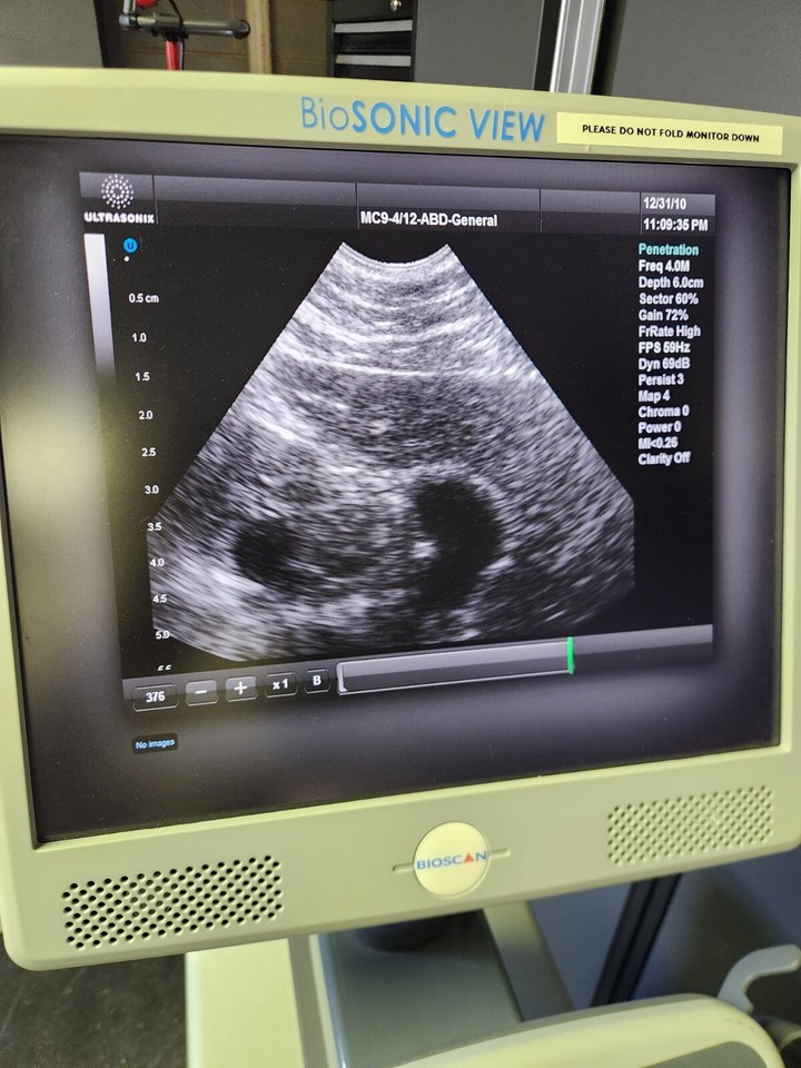 ULTRASONIX Bio SONIC WAVE Ultrasound Machine | eBay