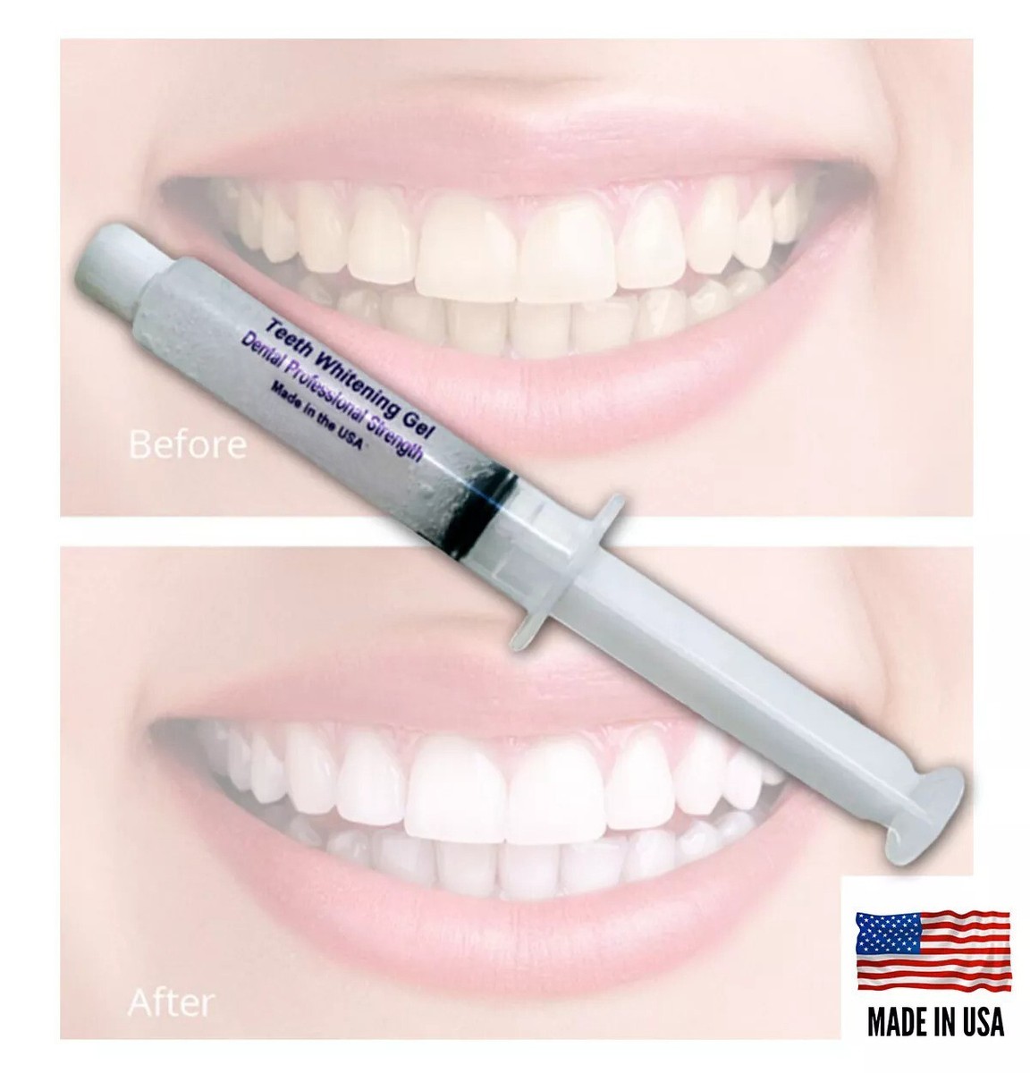 44% TEETH WHITENING PROFESSIONAL DENTAL SYSTEM KIT AT HOME 10 GEL