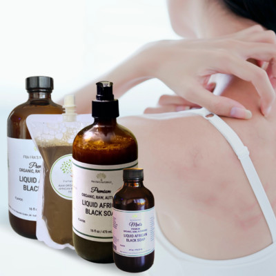 Fra Fra's Naturals | Premium Healing Eczema Liquid Black Soap Blend - 16 oz