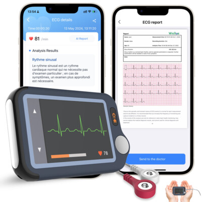AI EKG Monitor 30s/60s/5min Recording,Work with APP/PC software,free AI analysis