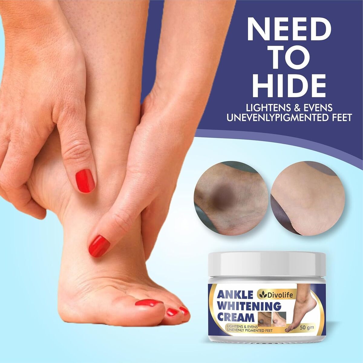 Ankle Whitening Cream For Men And Women | For ankle, knee, finger,Dark Body Part | eBay Ankle Whitening Cream For Men And Women | For ankle, knee, finger,Dark Body Part | eBay