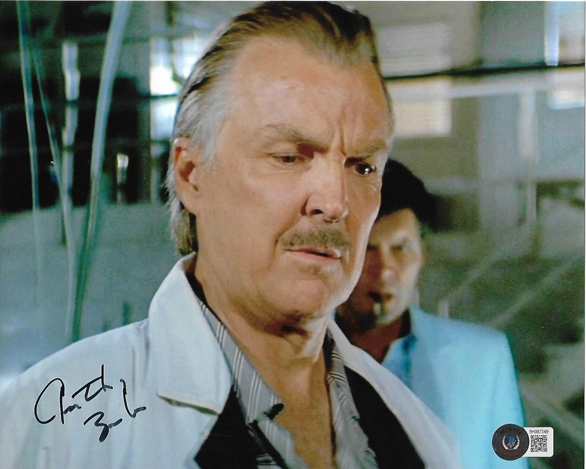 Have A Why Does Anthony Zerbe Glass Eye