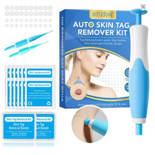 Auto Micro Skin Tag Remover Device Kit Safe Painless Removal 2-8 mm Band Tool