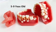 Dental Teaching Pediatrics Teeth Children 5-9Years Old Permanent Alternate Model