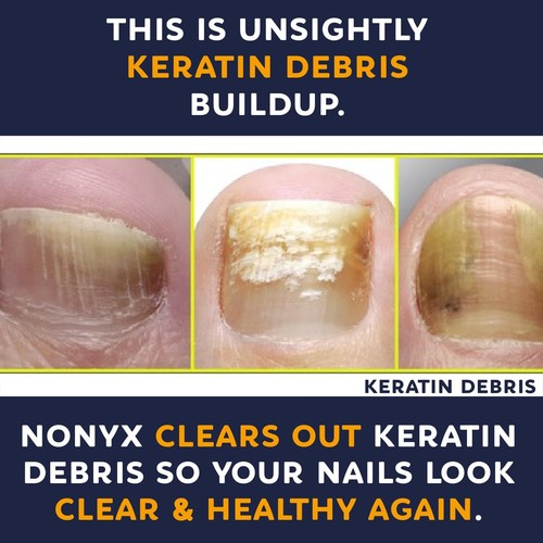 NONYX Nail Clarifying Gel | For Clear, Healthy-Looking Nails | Improves the A... - Picture 7 of 7