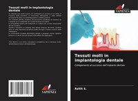 Rohit S. | Tessuti Molli In Implantologia Dentale | Taschenbuch | Italienisch