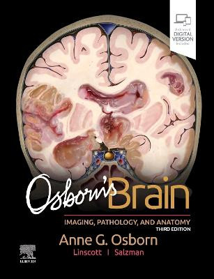 Osborn's Brain - 9780443109379