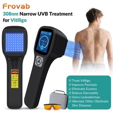 308nm UVB Phototherapy Lamp Narrowband UVB Light for Skin Diseases 5-50mW/cm 