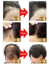 Biotin Hair Growth Spray