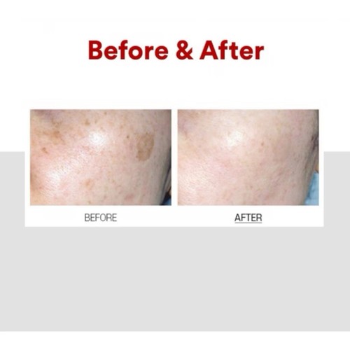 Medipeel Melanon X Cream 30ml - Picture 2 of 4