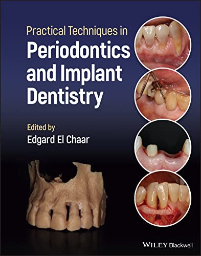 Practical Techniques in Periodontics and Implant Dentistry by Edgard El Chaar - Image 3