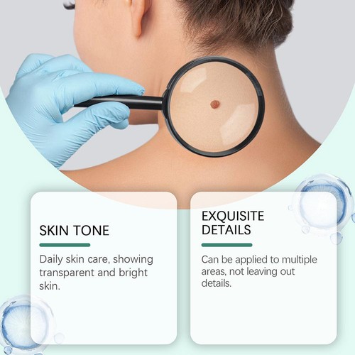 Gentle Erase Rapid Mole Spot Elimination Gel -dark Spot Removal for Face New - Picture 8 of 20