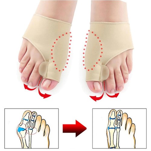 1 par separador de dedos Hallux Valgus juanete corrector martillo enderezador pie - Imagen 5 de 14