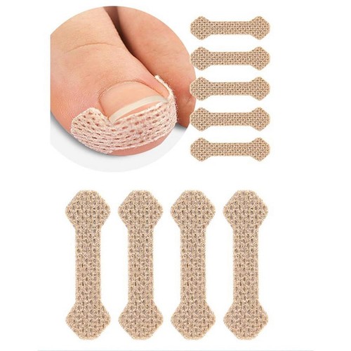 Ingrown Toenail Treatment: 120Pcs Breathable Ingrown Toenail Corrector Strips - - Picture 2 of 11
