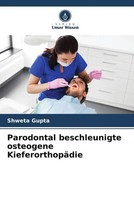Shweta Gupta | Parodontal Beschleunigte Osteogene KieferorthopäDie | Taschenbuch