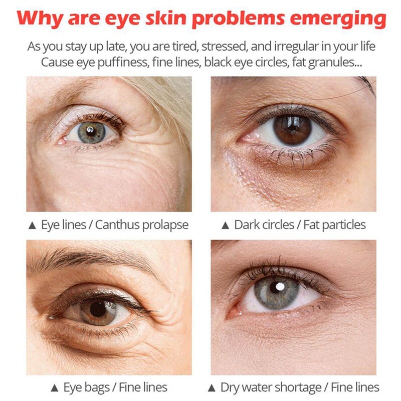 2x Under Eye Cream Gel Anti Aging Dark Circles Remove Crows Feet Bags