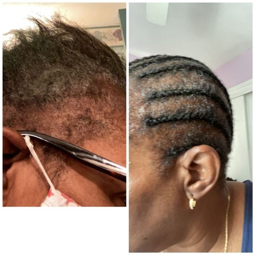 Hair Growth Oil for Scalp & Hair Strengthening For Split Ends and Dry Scalp- - Picture 5 of 11