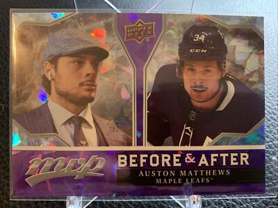 2021-22 Upper Deck MVP AUSTON MATTHEWS Before & After Purple Ice MAPLE LEAFS SP