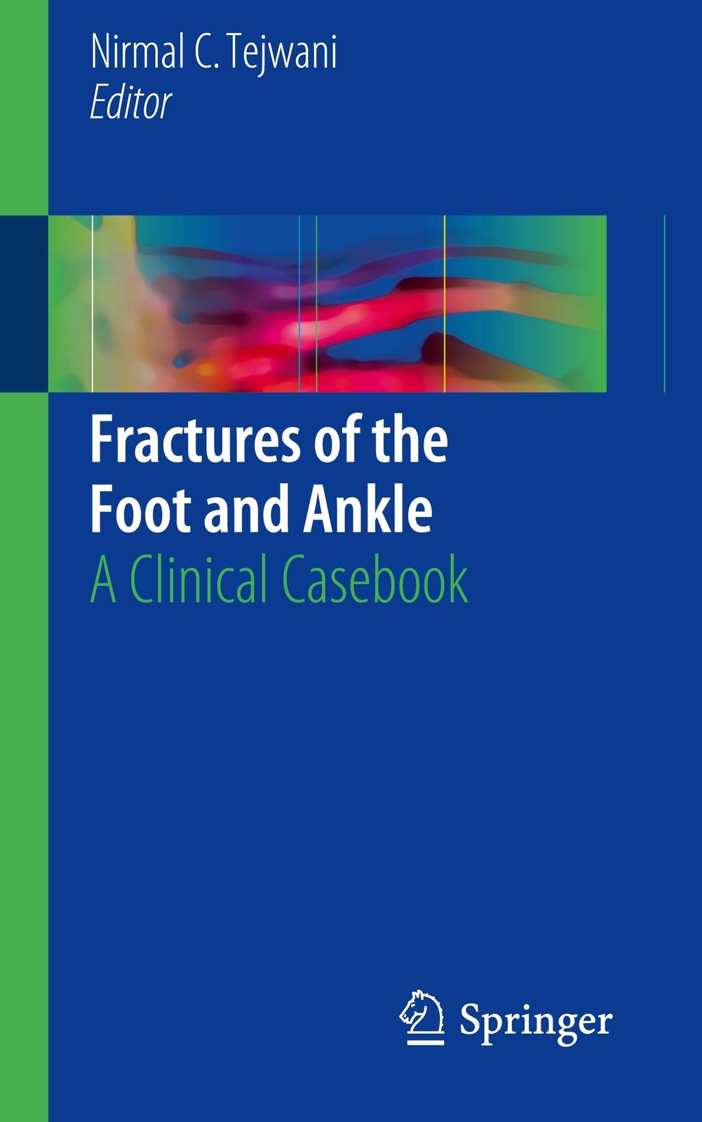 Thumbnail - Fractures Of The Foot And Ankle A Clinical Casebook Nirmal C. Tejwani