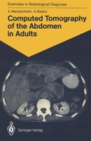 Auguste Wackenheim (U. A.) | Computed Tomography Of The Abdomen In Adults | Buch