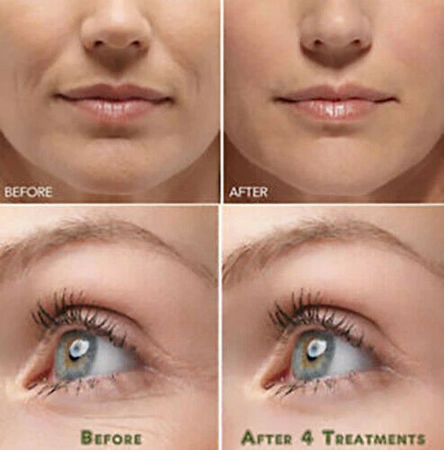 HYALURONIC ACID 100% Pure Anti Aging Hydrating Serum, Plumps Wrinkles Fine Lines - Image 3 of 4