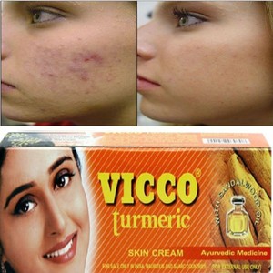 vicco turmeric for acne
