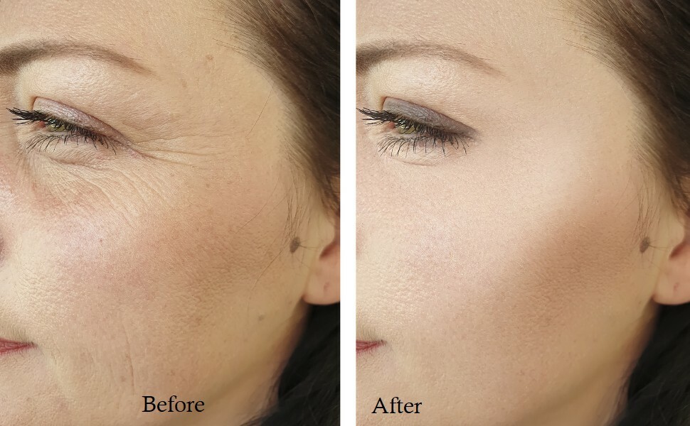 CREMA CORPO IDRATANTE DOPO SOLE ACIDO IALURONICO - Foto 8